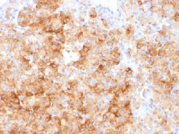 Chromogranin A / CHGA Antibody