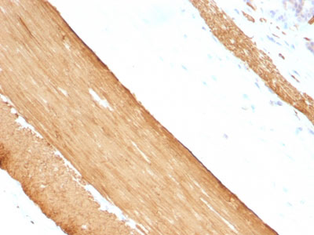 Actin, Muscle Specific (Muscle Cell Marker) Antibody - With BSA and Azide