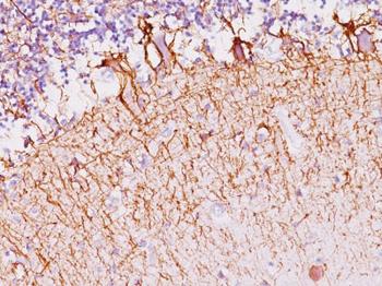 Neurofilament (H+L) (Neuronal Marker) Antibody - With BSA and Azide