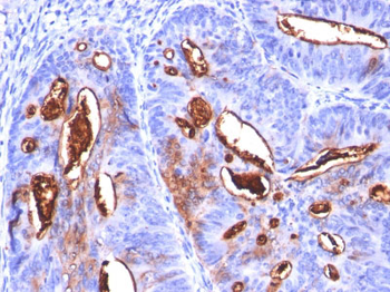 CA19-9 / Sialyl Lewisa (GI Tumor Marker) Antibody - With BSA and Azide