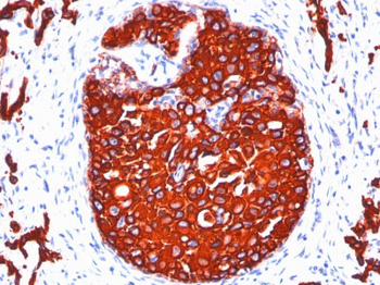 Cytokeratin, pan (Epithelial Marker) Antibody - With BSA and Azide