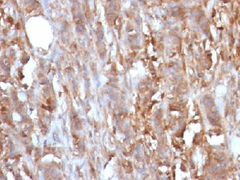 Beta-2 Microglobulin (Renal Failure & Tumor Marker) Antibody - With BSA and Azide