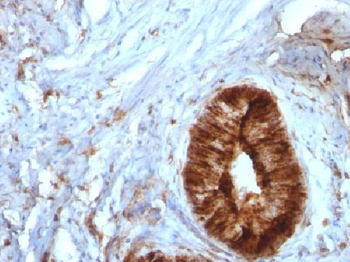 Beta-2 Microglobulin (Renal Failure & Tumor Marker) Antibody - With BSA and Azide
