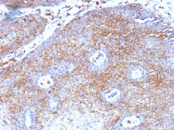 Beta-2 Microglobulin (Renal Failure & Tumor Marker) Antibody - With BSA and Azide