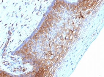 Beta-2 Microglobulin (Renal Failure & Tumor Marker) Antibody - With BSA and Azide