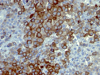 NGF-Receptor (p75) / CD271 (Soft Tissue Tumor Marker) Antibody - With BSA and Azide