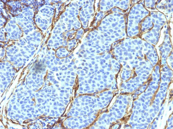 NGF-Receptor (p75) / CD271 (Soft Tissue Tumor Marker) Antibody - With BSA and Azide