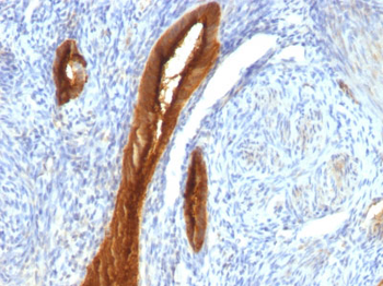 MUC1 / EMA / CD227 (Epithelial Marker) Antibody - With BSA and Azide
