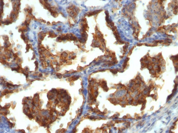 MUC1 / EMA / CD227 (Epithelial Marker) Antibody - With BSA and Azide