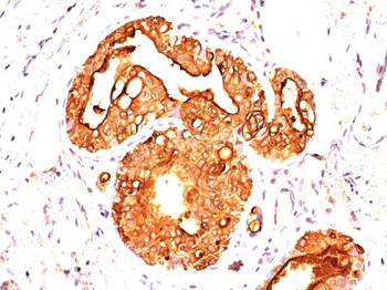 MUC1 / EMA / CD227 (Epithelial Marker) Antibody - With BSA and Azide