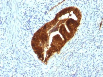 Cytokeratin 19 (KRT19) (Pancreatic Stem Cell Marker) Antibody - With BSA and Azide