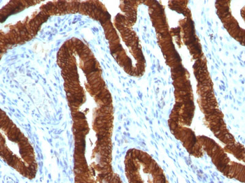 Cytokeratin 19 (KRT19) (Pancreatic Stem Cell Marker) Antibody - With BSA and Azide