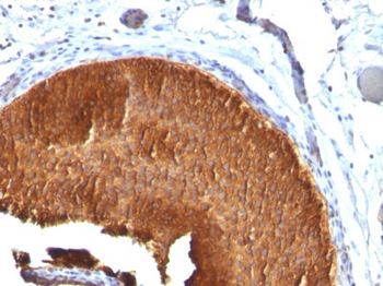 Cytokeratin 19 (KRT19) (Pancreatic Stem Cell Marker) Antibody - With BSA and Azide