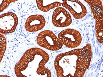 Cytokeratin 18 (KRT18) Antibody - With BSA and Azide