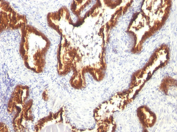 Cytokeratin 18 (KRT18) Antibody - With BSA and Azide