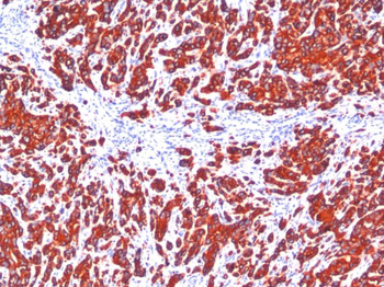 Cytokeratin, pan (Epithelial Marker) Antibody - With BSA and Azide
