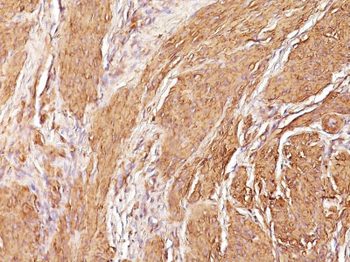 Actin, Muscle Specific (Muscle Cell Marker) Antibody - With BSA and Azide