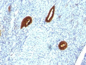 Cytokeratin 19 (KRT19) (Pancreatic Stem Cell Marker) Antibody - With BSA and Azide