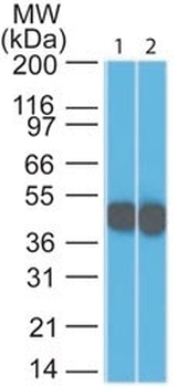 Cytokeratin 18 (KRT18) Antibody - With BSA and Azide