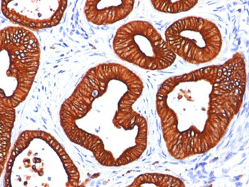 Cytokeratin 18 (KRT18) Antibody - With BSA and Azide