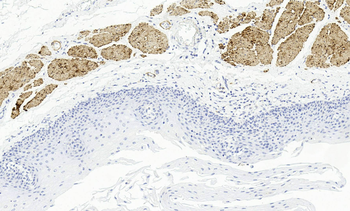 Smoothelin Antibody