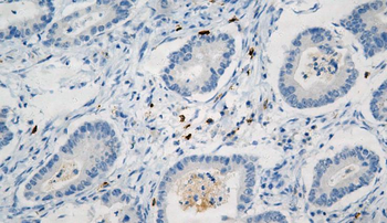 CD25 Antibody