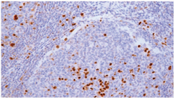 PWWP3A Antibody