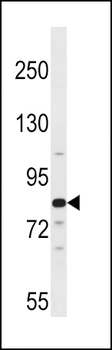 ARNT2 Antibody (Center)
