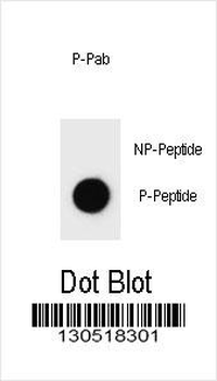 Phospho-M ERBB2(Y1140) Antibody