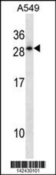HOXD12 Antibody (C-term)