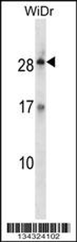 KLK12 Antibody (Center)