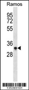 Mouse Aurkb Antibody (N-term)