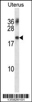 PMP22 Antibody