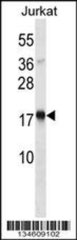 TSLP Antibody (C-term)