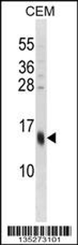 SPRR3 Antibody (C-term)