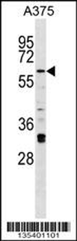 Mouse Irak2 Antibody (C-term)