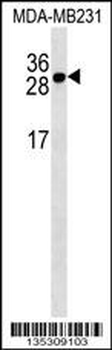 TNFRSF17 Antibody (Center)