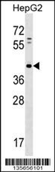 PAP2D Antibody (Center)