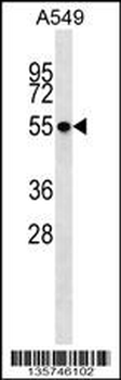 STK17B Antibody (C-term)