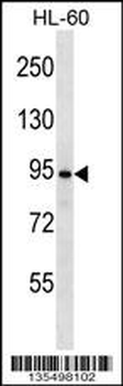 UBP37 Antibody (N-term)