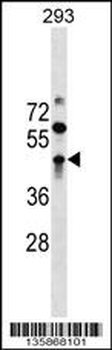 ZBTB32 Antibody (N-term)