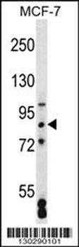 SATB2 Antibody (Center)
