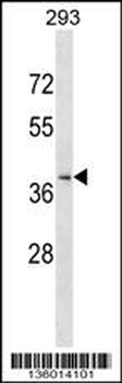 CCRL2 Antibody (Center)