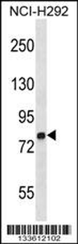 MMP9 Antibody (C-term)