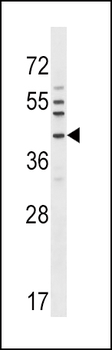 NKX6-1 Antibody (C-term)