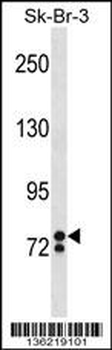 ZNF263 Antibody (Center)