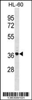 TNIP2 Antibody (Center)