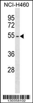 EPOR Antibody (Center)