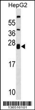 ZNRF1 Antibody (Center)