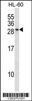 RAB15 Antibody (Center)
